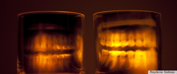 Skeleton xray teeth candles